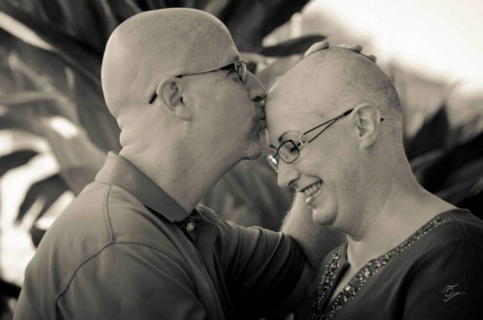 Man and woman without hair kissing